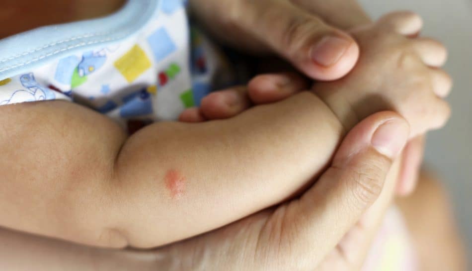 punture zanzare neonati